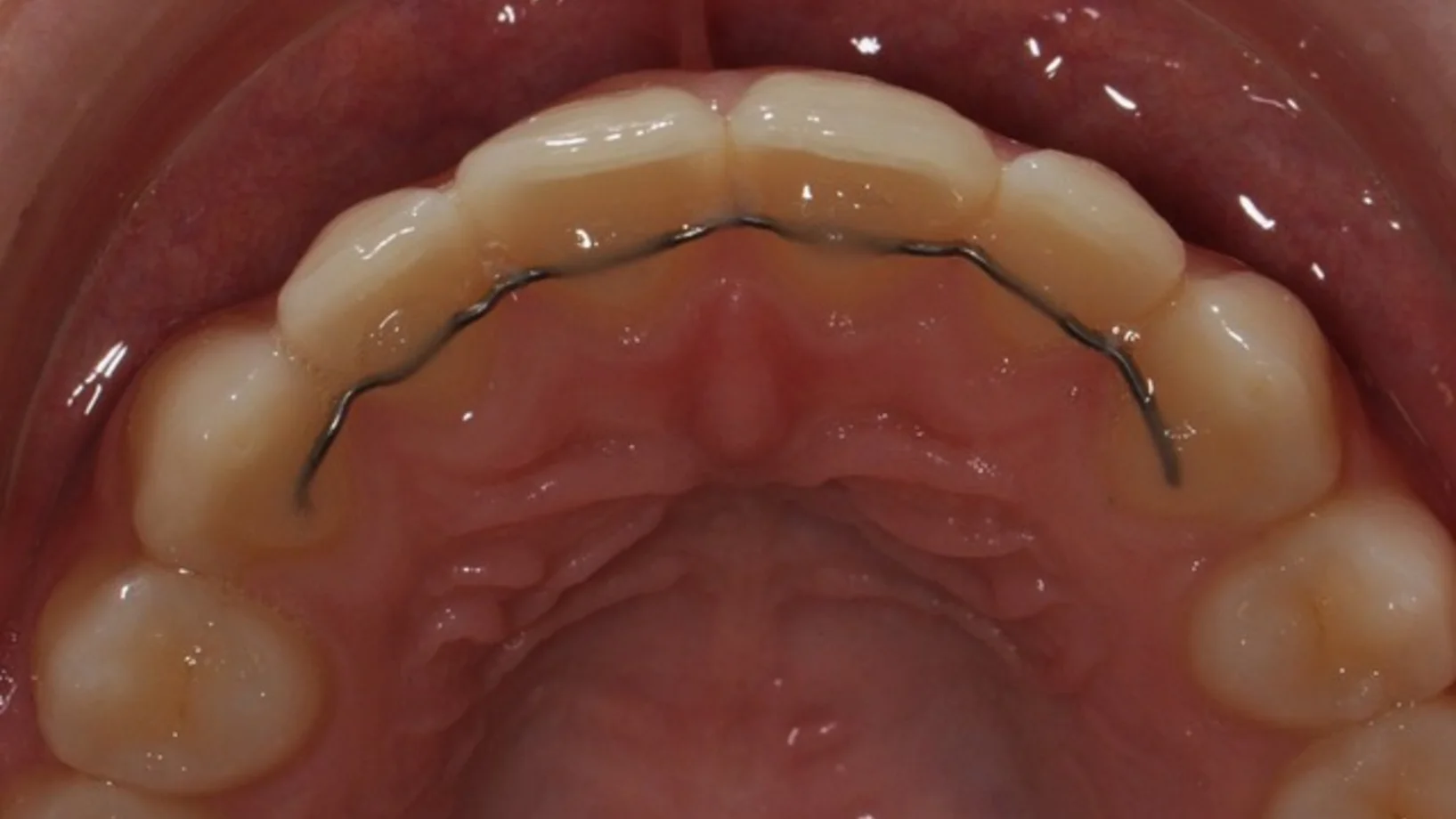 Blog S.W._Retainer.jpeg
